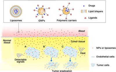 Potential Applications of Nanotechnology in Urological Cancer